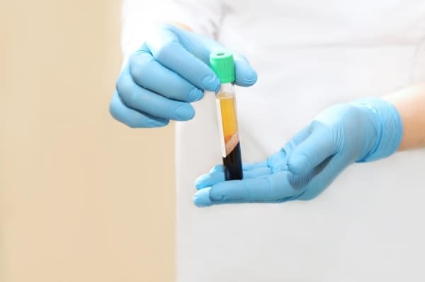 Plasma collection center CSL Plasma opening in McKinney