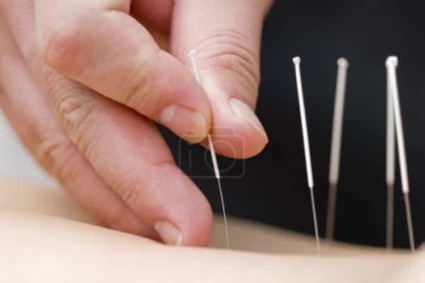 The Point Acupuncture and Herbal Clinic finds new location in New Braunfels