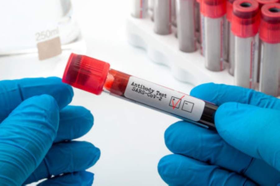 UPDATE: Williamson County commissioners approve purchase of antibody coronavirus tests for first responders