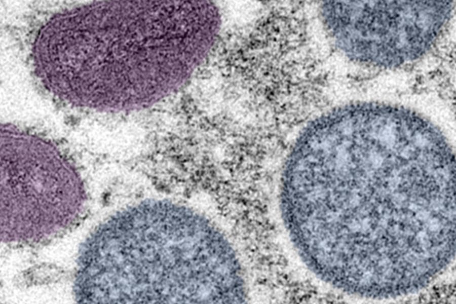 First cases of monkeypox identified in Bexar County