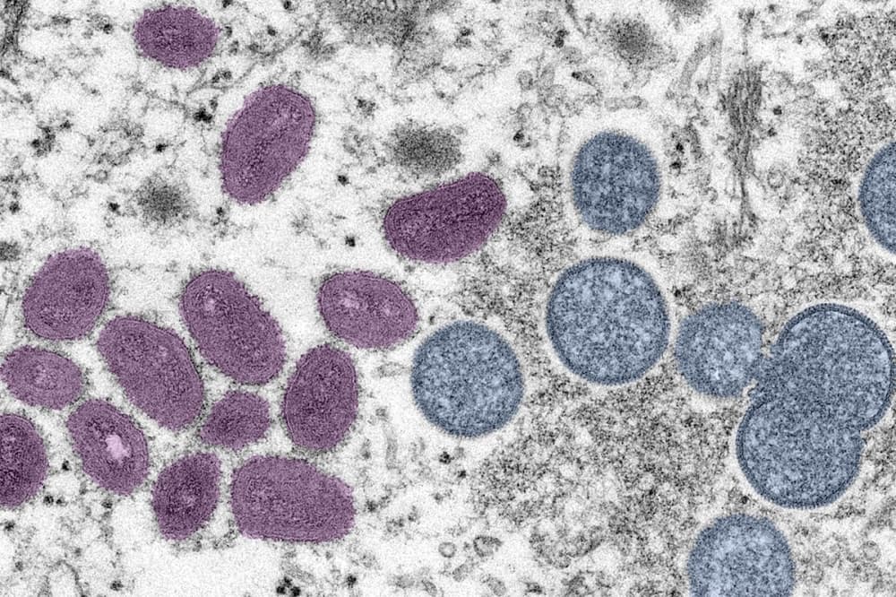 Houston will soon test wastewater to monitor monkeypox levels in community