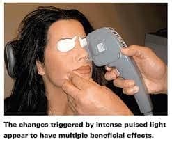 Pflugerville Vision Care has the latest version of IPL that does not require a gel to be spread on the skin and requires fewer zaps of heat. 