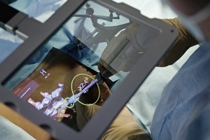 Medical City Frisco first in state to use artificial intelligence, augmented reality system in spinal surgeries