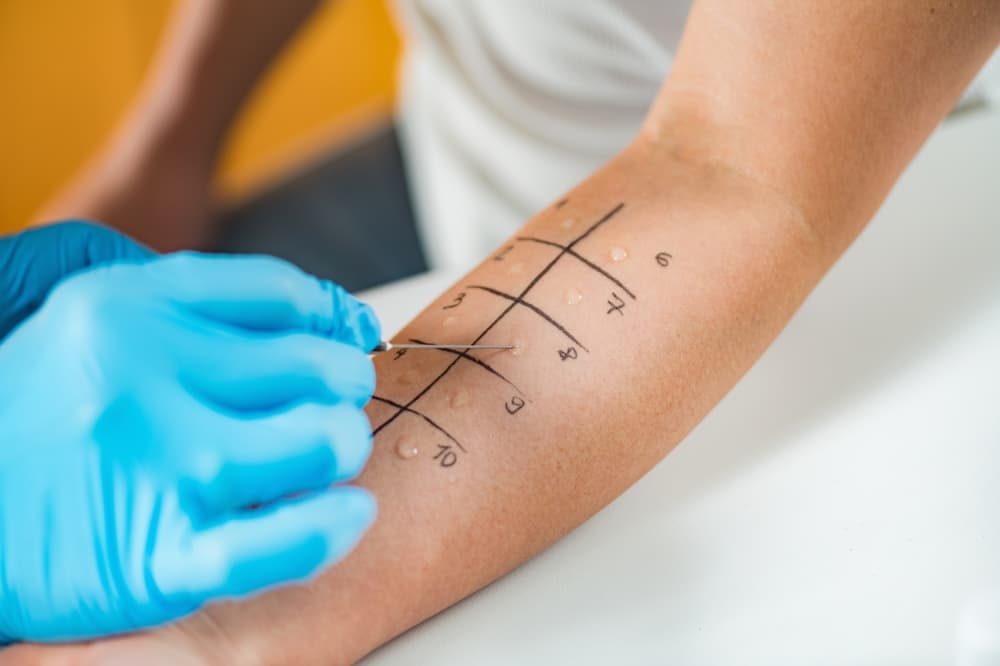 TexasAllergyMD brings allergy diagnosis, management services to Southlake