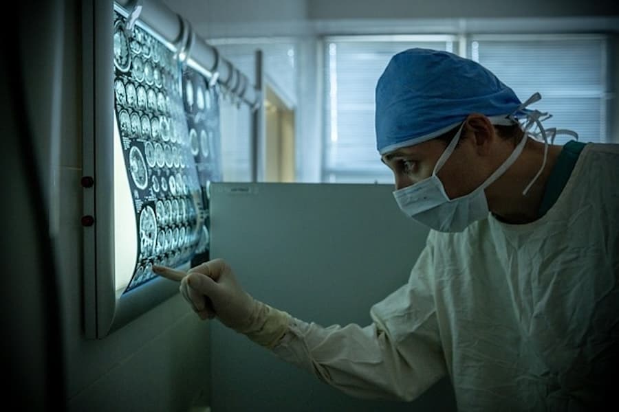 Lung cancer screening guidelines revised to include ages 50-80