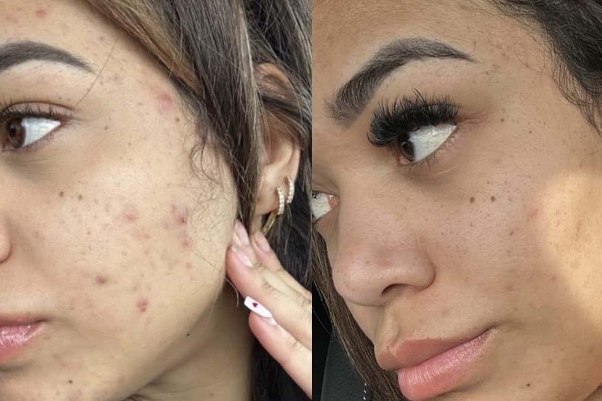 Amazon Aesthetics and Laser to bring facials, injections to Frisco