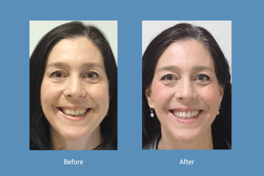 No more expanders, jaw surgery: Dr. Jennifer Buchanan transforms smiles with latest technology