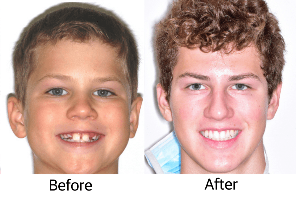 Round Rock Orthodontics emphasizes early orthodontic evaluation, provides free consultations