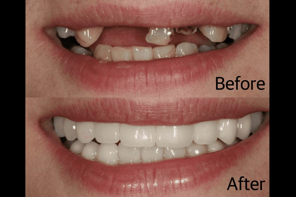 Aesthetic Dentistry Associates revolutionizes dental implant process with transformative approach, technologies, specialty implant center