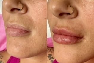 ATX Beauty & Body Art now open in Round Rock, offering piercings, facial injections and treatments