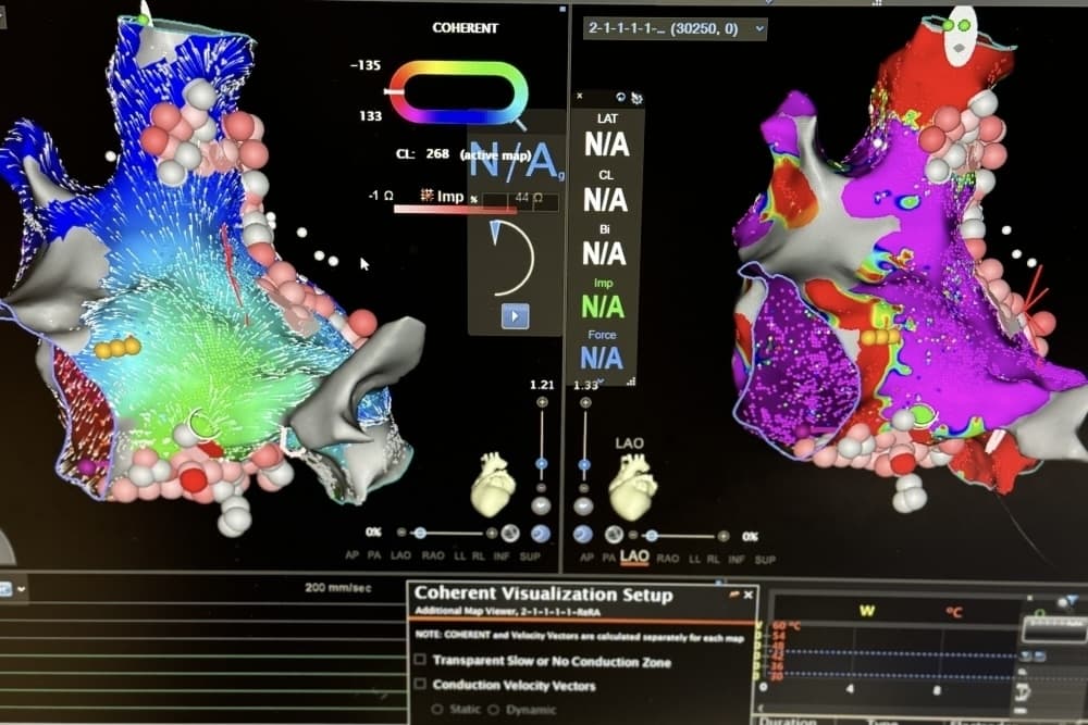 Electrophysiology program offers personalized care, advanced technology in New Braunfels