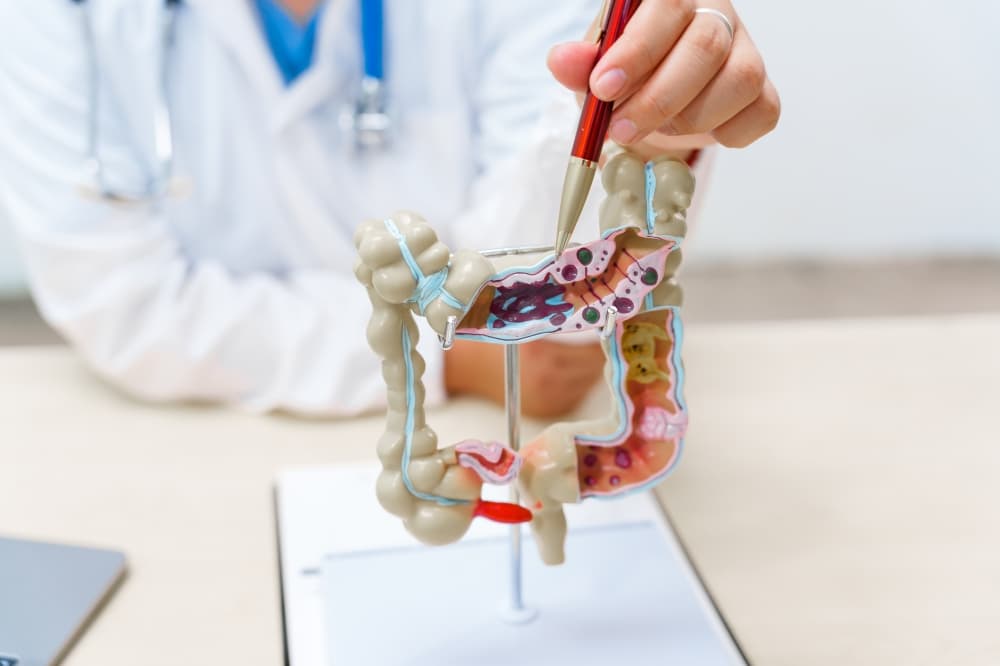 Dr. Cesar Santiago shares 3 key takeaways about colorectal cancer screening, prevention