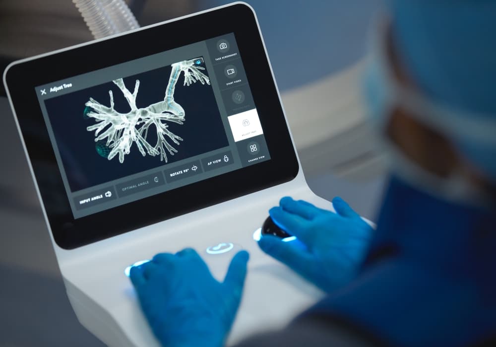 Early detection, advanced care: CHRISTUS offers lifesaving lung cancer screening in New Braunfels