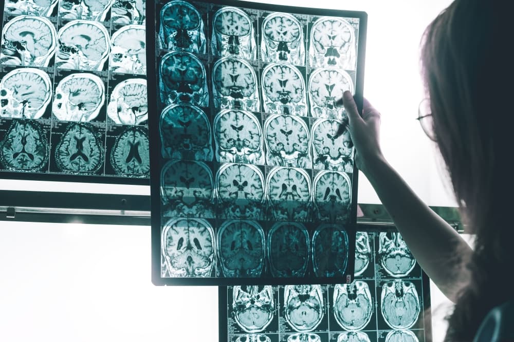 Nov. 4 election: Proposition 14 could make Texas a ‘leader’ in dementia research