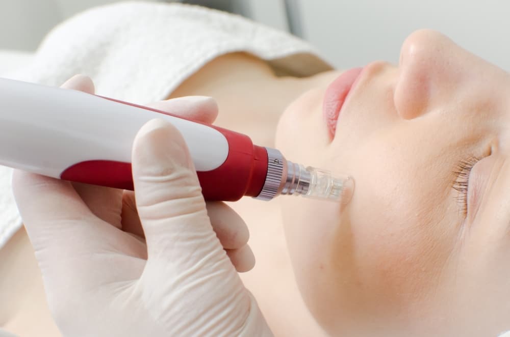 Holistic acne treatment business MV Skin Consulting is now open in Plano