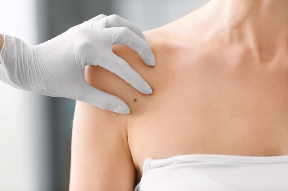 Catalyst Dermatology to open in Prosper