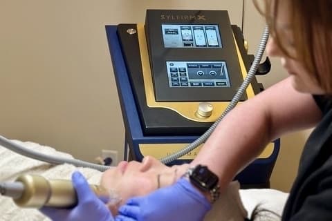 microneedling