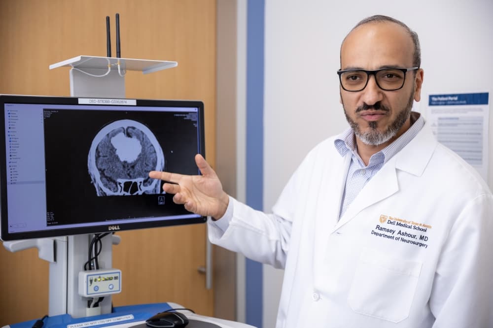 Ascension Seton to deploy mobile stroke unit in 2027