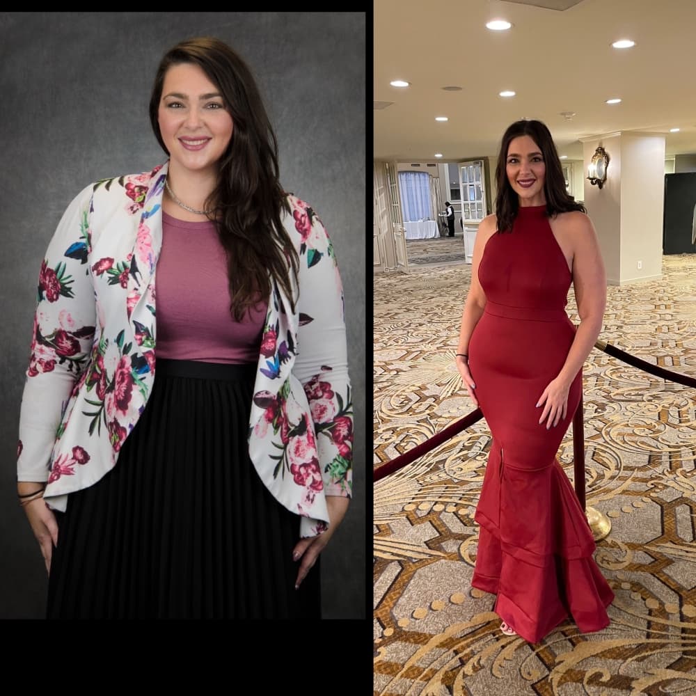 ‘More than a number on the scale: Patients' lives transformed by bariatric surgery at UTMB Health