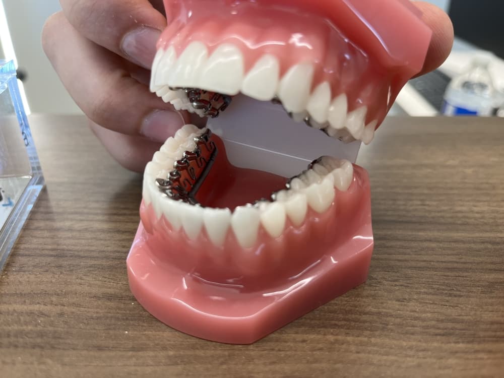 Wink Orthodontics offers braces in Prosper