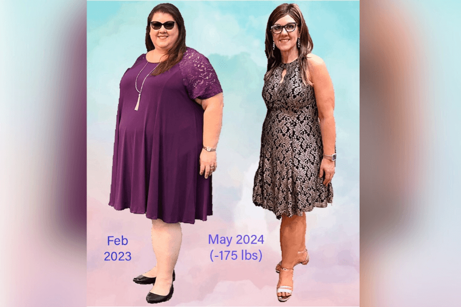 Beyond weight loss: UTMB Health’s Bariatric Surgery Department transforms patients' lives through weight loss surgery