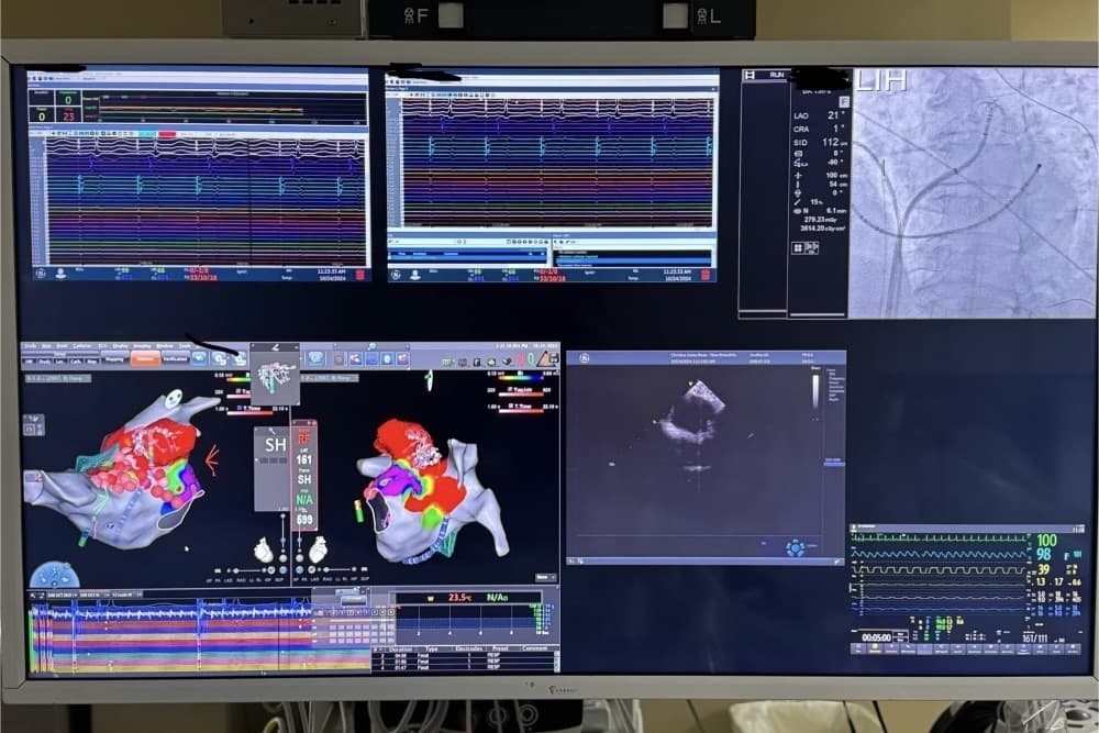 Electrophysiology program offers personalized care, advanced technology in San Marcos