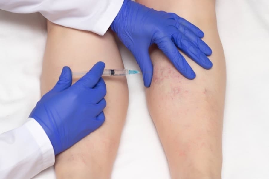 The Vein Center now open in The Woodlands area