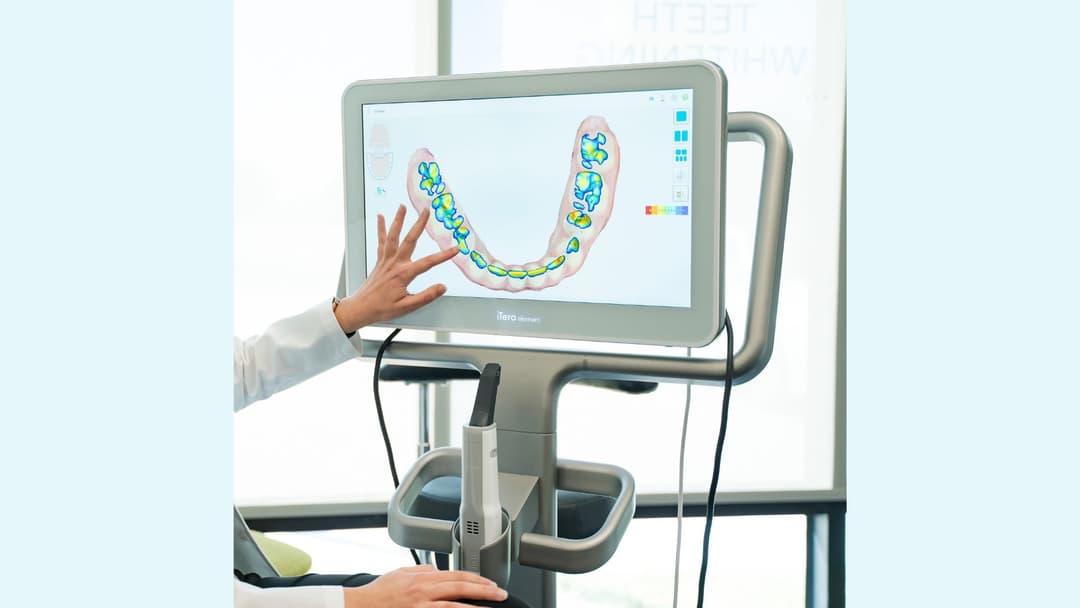 Dentist points to iTero scanner screen showing a 3D digital dental scan with color-coded tooth mapping.