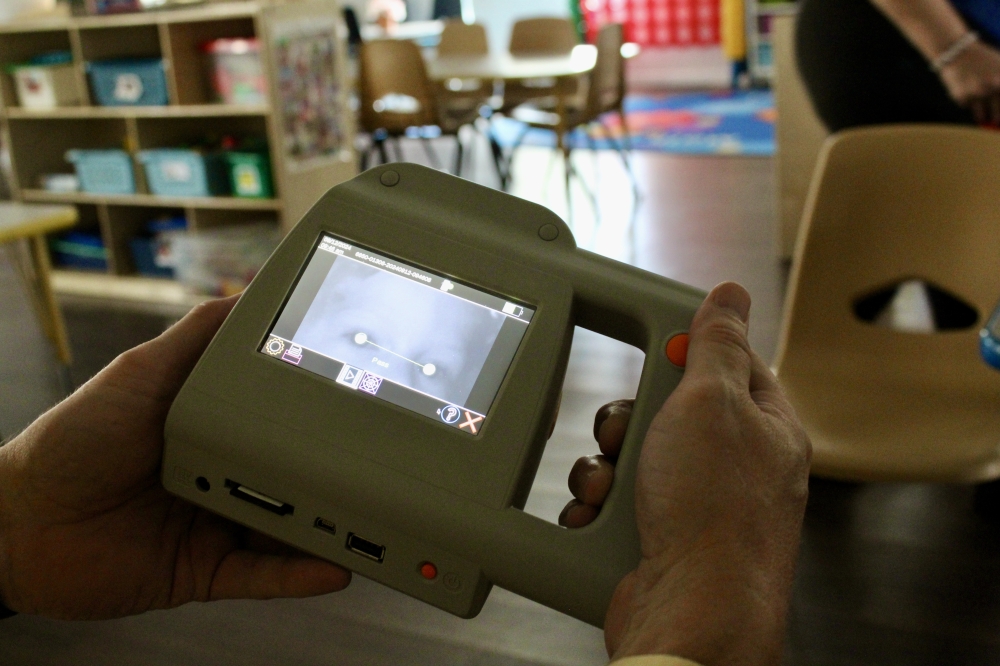 Lions Club’s KidSight utilizes a camera by Plusoptix which can detect vision problems within 30 and cost the Martins $6,0000. (Jovanna Aguilar/Community Impact)