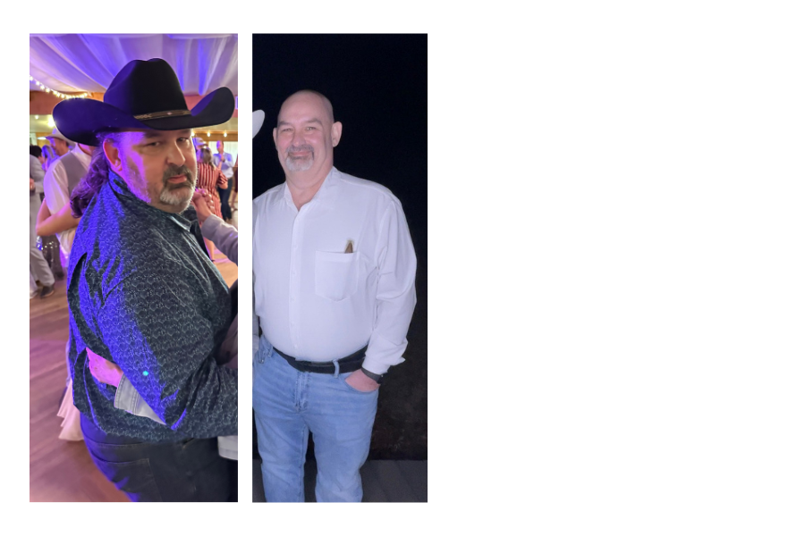 Don Sweeney a patient at UTMB Health who got gastric sleeve procedure before and after photos