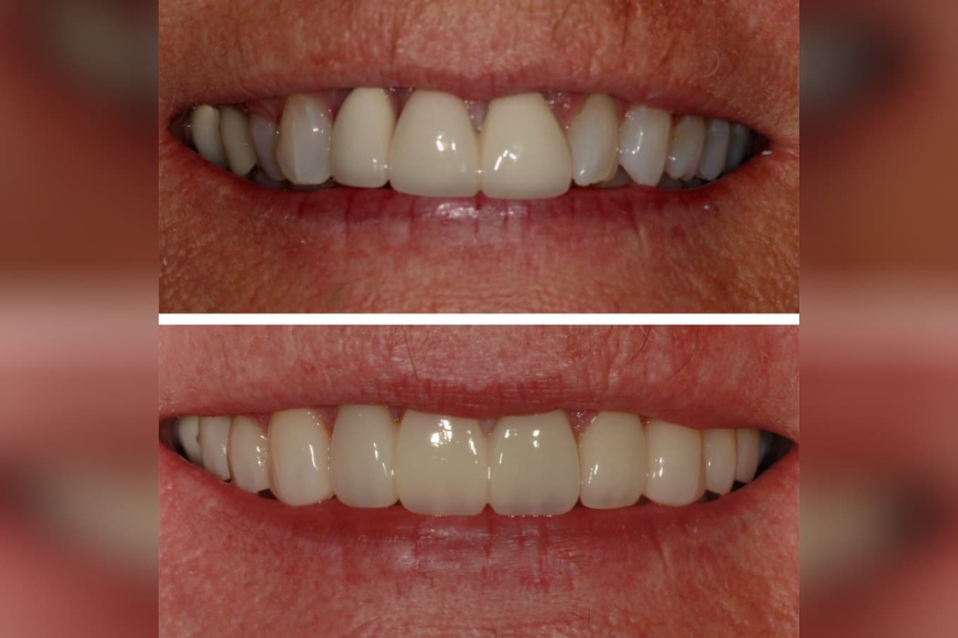 C & C Dental’s Dental Savings Plan helps Sugar Land patients save on dental care